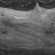 285bw# 285bw#